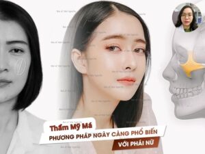 Phẫu thuật thẩm mỹ má