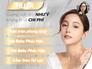 Phẫu thuật thẩm mỹ má filler